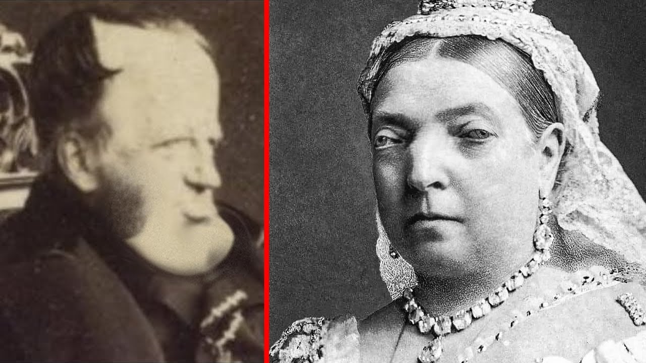 The Most Inbred Monarchs In History - YouTube