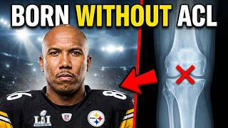 What Happens When an NFL Star Has No ACL