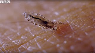 Presenter Gives Himself Head Lice On Purpose! | Earth Lab