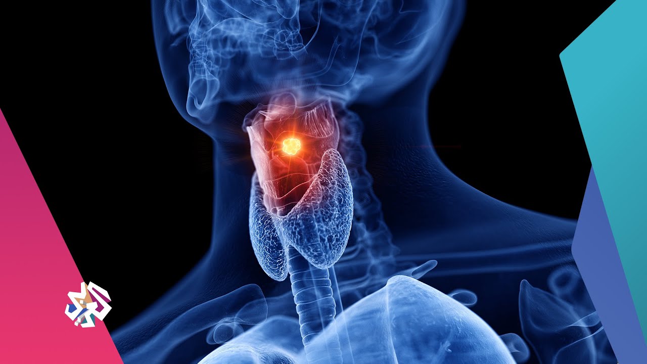 الحبال الصوتية .. أسباب تلفها وطرق علاجها | صباح النور