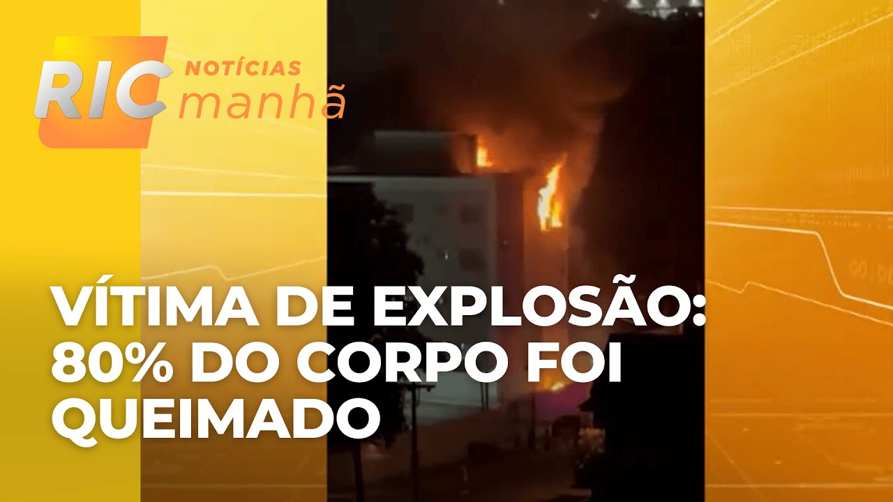 Vítima de explosão em apartamento em Foz do Iguaçu teve 80% do corpo queimado e está internado