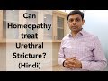 Can Homeopathy treat Urethral Stricture? | Hindi