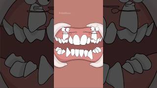 Braces Fix Crooked Teeth