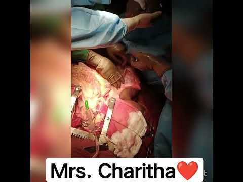 Mrs. charitha Brain Death Patient Organs Donated In KIMS Hospital? Kurnool Respected women ??