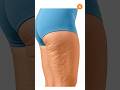 Firm Thighs Workout 💪 Strengthen &amp; Smooth Appearance