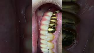 implant stomatolog dental dentist teeth stom dentalclinic urganch