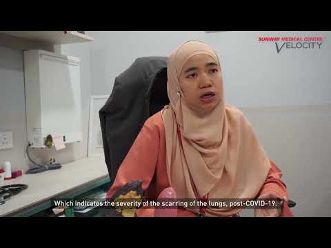 Pure Cryptogenic Organizing Pneumonia Patient Stories Story - hkcytb5