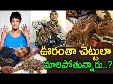 ఈ గ్రామంలో మనుషులంతా చెట్లలాగా మారిపోతున్నారు | Humans Turn into Human Tree Inthis Village Sumantv