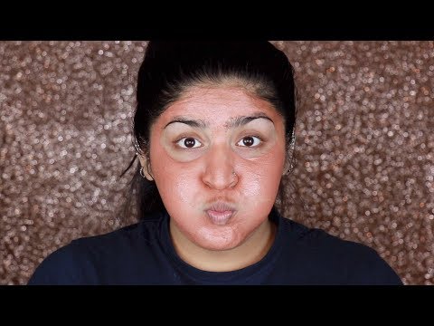  Face Masks/Packs For Acne & Acne Prone Skin | All Budgets and Skin Types | Shreya Jain