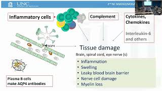 NMOSD: Current and Emerging treatment options