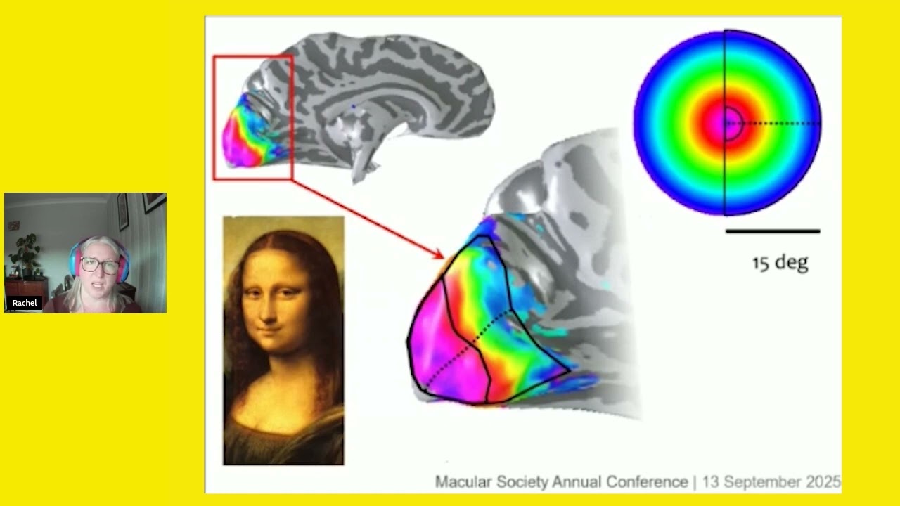 What is the relationship between vision and the brain? with Dr What is the relationship between vision and the brain? with Dr