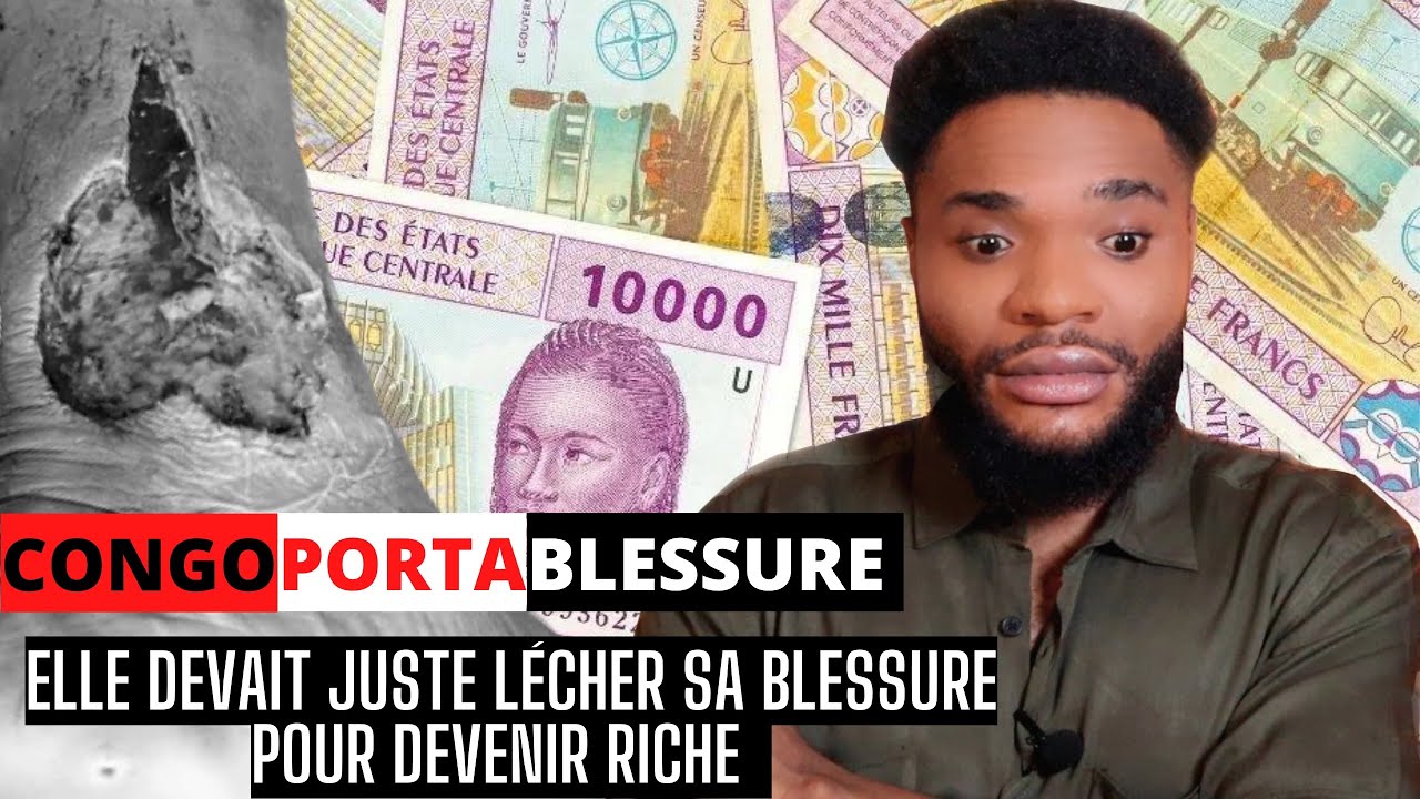 🇨🇬 CONGO PORTA BLESSURE : LA CONDITION POUR ETRE RICHE ETAIT DE LECHER LA BLESSURE DU MILLIADAIRE