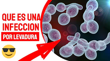 ¿Cuál es la causa del exceso de levadura en las mujeres?