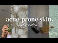 How I cleared my acne prone skin ♡ morning &amp; nighttime skincare routine