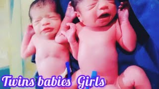 Twins Newborn baby Girls After Birth || Good crying baby Immediately After birth 🤩🔚||