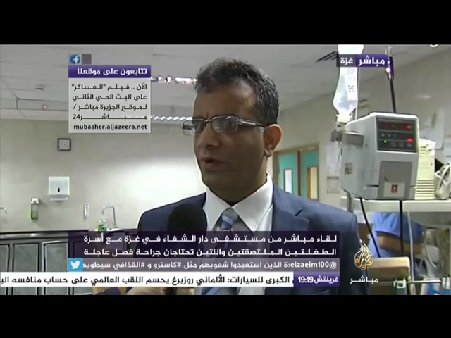 توأم ملتصق في غزة بحاجة جراحة فصل عاجلة