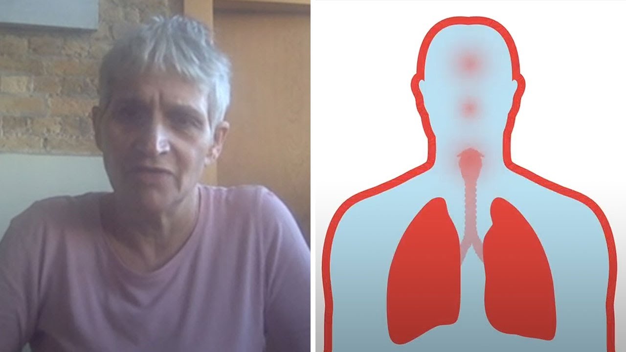How the doctor who survived coronavirus beat the disease thumbnail