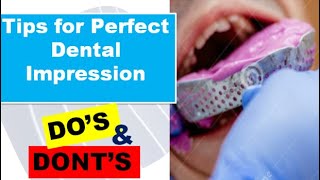 Tips for PERFECT DENTAL IMPRESSION