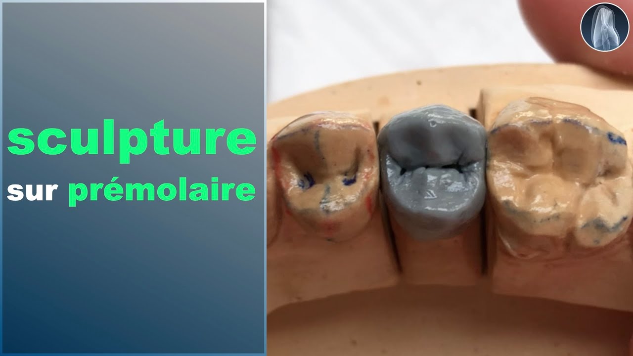 Sculpture en cire simplifiée : Maîtrisez la prémolaire maxillaire étape par étape ! 🦷✨”
