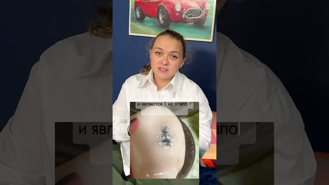 Осторожно- Кальмар!!!!! #паразиты #паразитывкальмаре #червивкальмаре #интереснознать #кальмар