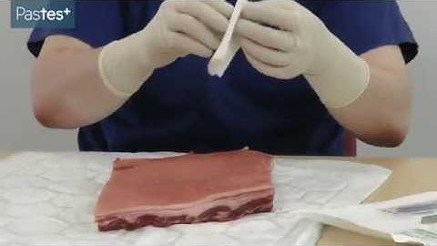 Surgical excision of a cutaneous lesion | MRCS OSCE