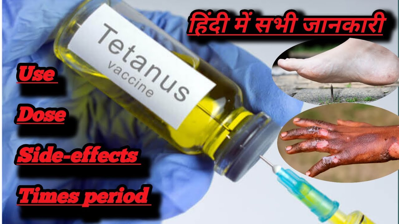 Tetanus Booster Dose Timing