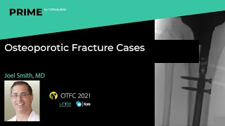Osteoporotic Fracture Cases - Joel Smith, MD