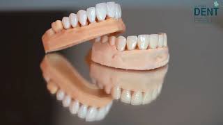 Veneers &amp; Crowns Side by Side 👀 Natural or Extra White?