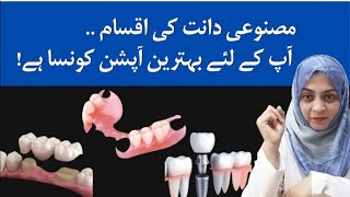 Denture, Bridge or Implant? Which one is best Artificial teeth screenshot 5