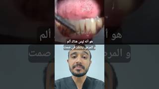 خطورة التهاب اللثة ؟ طبيب_أسنان المغرب dentiste maroc