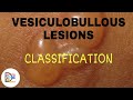 VESICULOBULLOUS LESIONS (CLASSIFICATION)