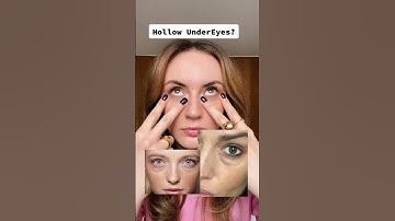 Improve under-eye hollowness & dark circles with face exercises | All You Can Face #shorts