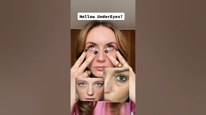 Improve under-eye hollowness & dark circles with face exercises | All You Can Face #shorts