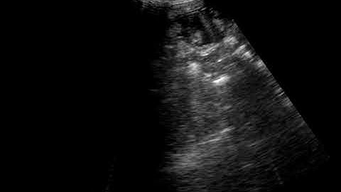 Asset 26244 2023 09 29 11 19 111 720x540 2250