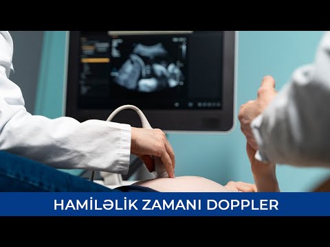 Video: Fil balığı: təbiətdə həyat və akvariumda saxlamaq