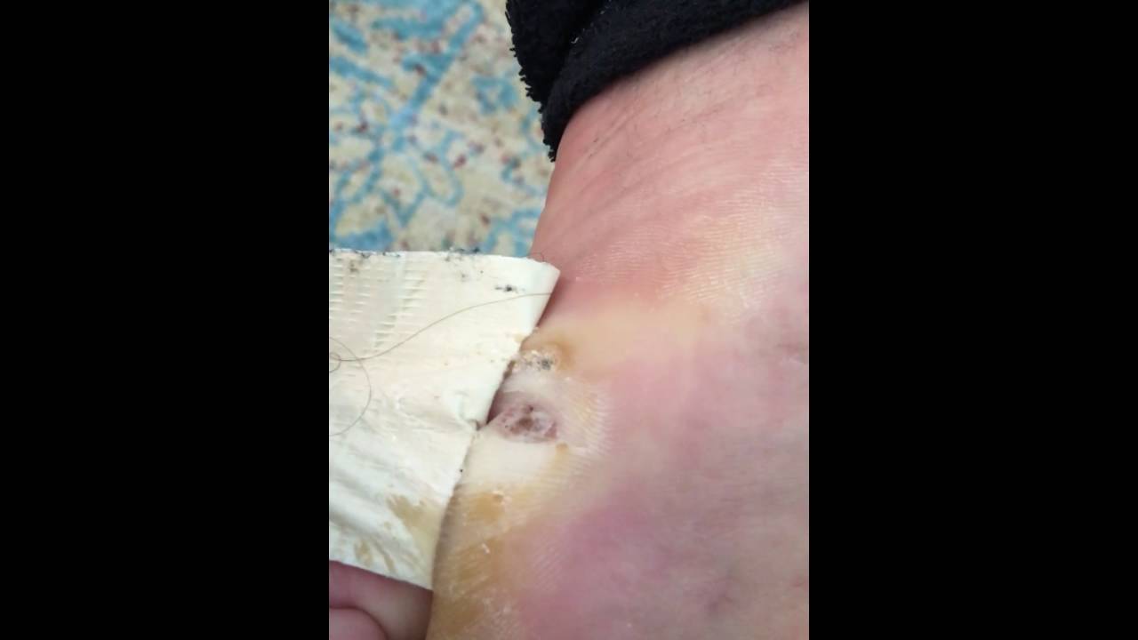 Pulled off the extra skin YouTube