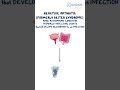 Reactive Arthritis (Reiter Syndrome)