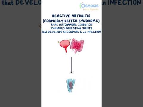 Video: Reiterin oireyhtymä - patogeneesi, oireet, diagnoosi, hoito, ennuste