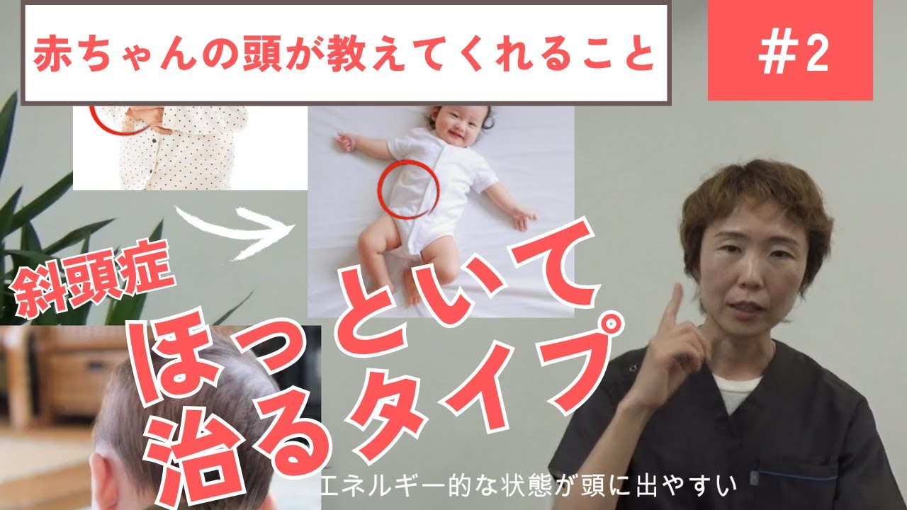 赤ちゃんの頭が教えてくれること②ほっといて治る子、治らない子｜斜頭症・絶壁・向きぐせ・歪み
