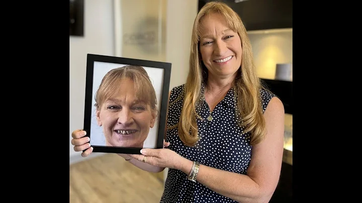 Lora's Story | Advanced Dental Implant Center of P...