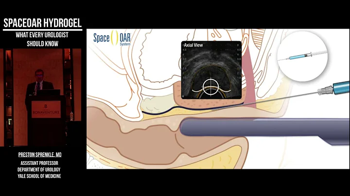 Preston Sprenkle -  What Every Urologist Should Kn...