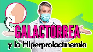 Galactorrea y la hiperprolactinemia - Dr. Mario Vega Carbó.