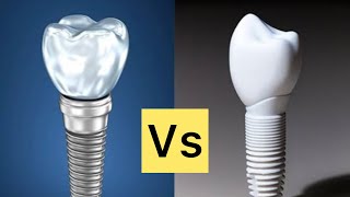 Zirconia Vs Anium Implants Which Is Better For You?