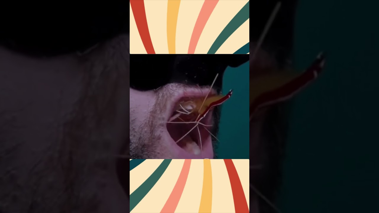 Dentist இறாளஂகளஂ 