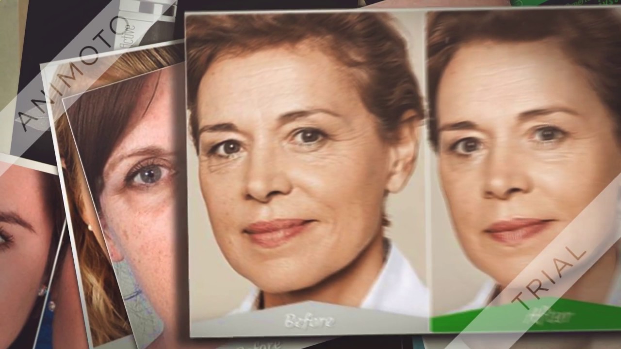 how to tighten under eye skin 