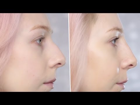 Wideo: Wymienione Są Sposoby Na Zmianę Kształtu Nosa Bez Operacji