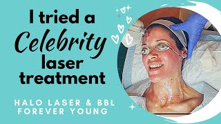 Can Halo laser & BBL Forever Young make my skin younger? I tried it!