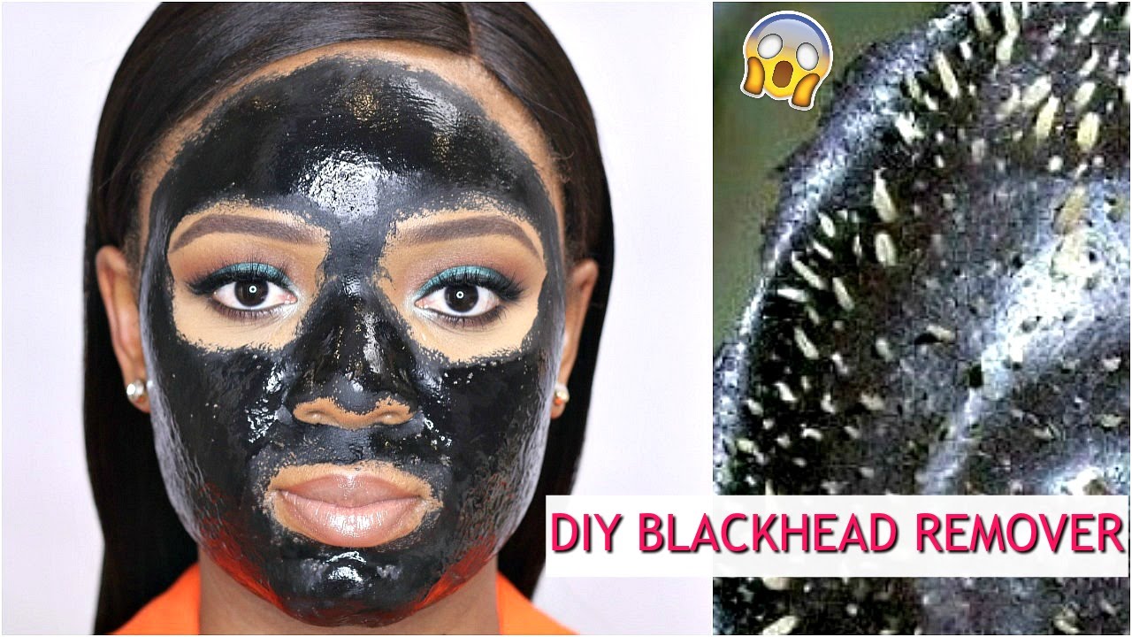 blackhead removal mask diy