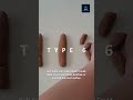 What Your Poop Shape Says About Your Health 🧻
