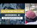 Rare Scarring Alopecia Case LIVE — Scalp Micro Pro Clinic